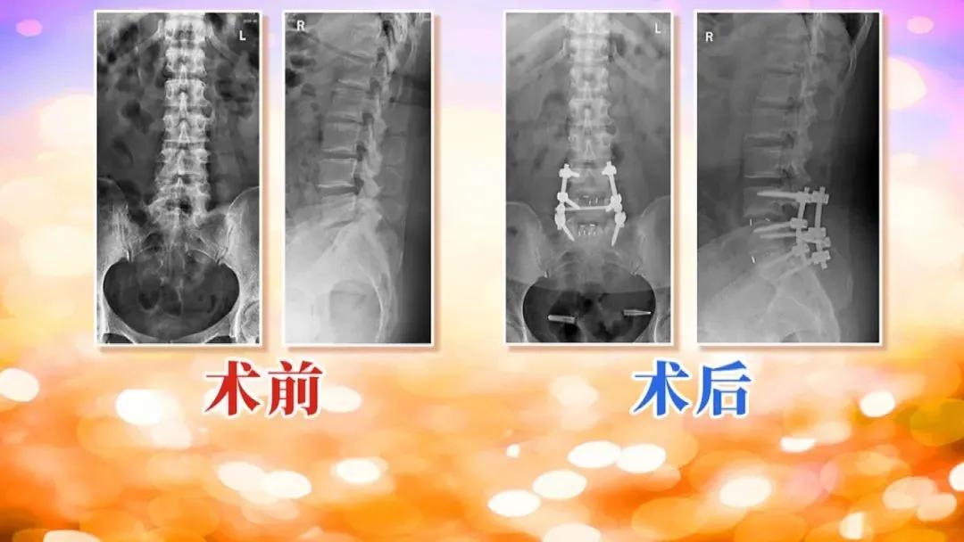 手机国补第一天，系统拥堵至瘫痪，全民热情引爆热点