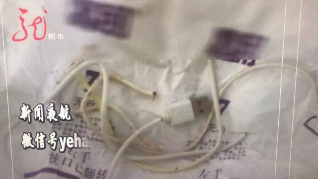 13岁男孩惊险一刻，55厘米数据线意外尿道，家长痛心疾呼警惕！