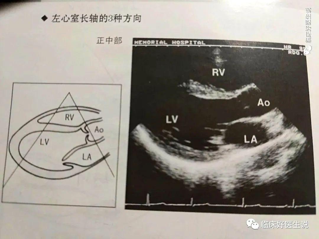 心碎成疾！丧夫之痛竟让她患上心碎综合征，医生警告，这种痛真的会要命！